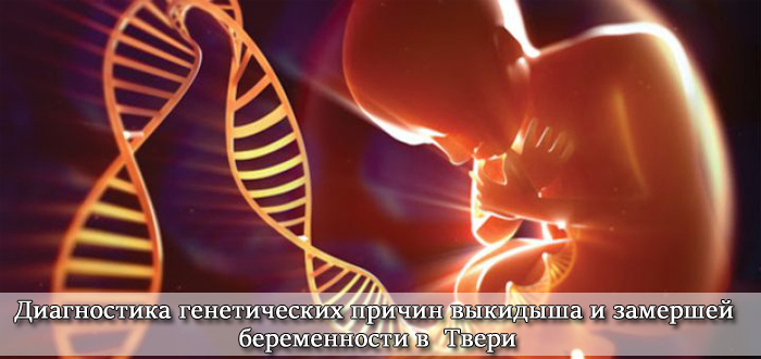Диагностика генетических причин в Твери